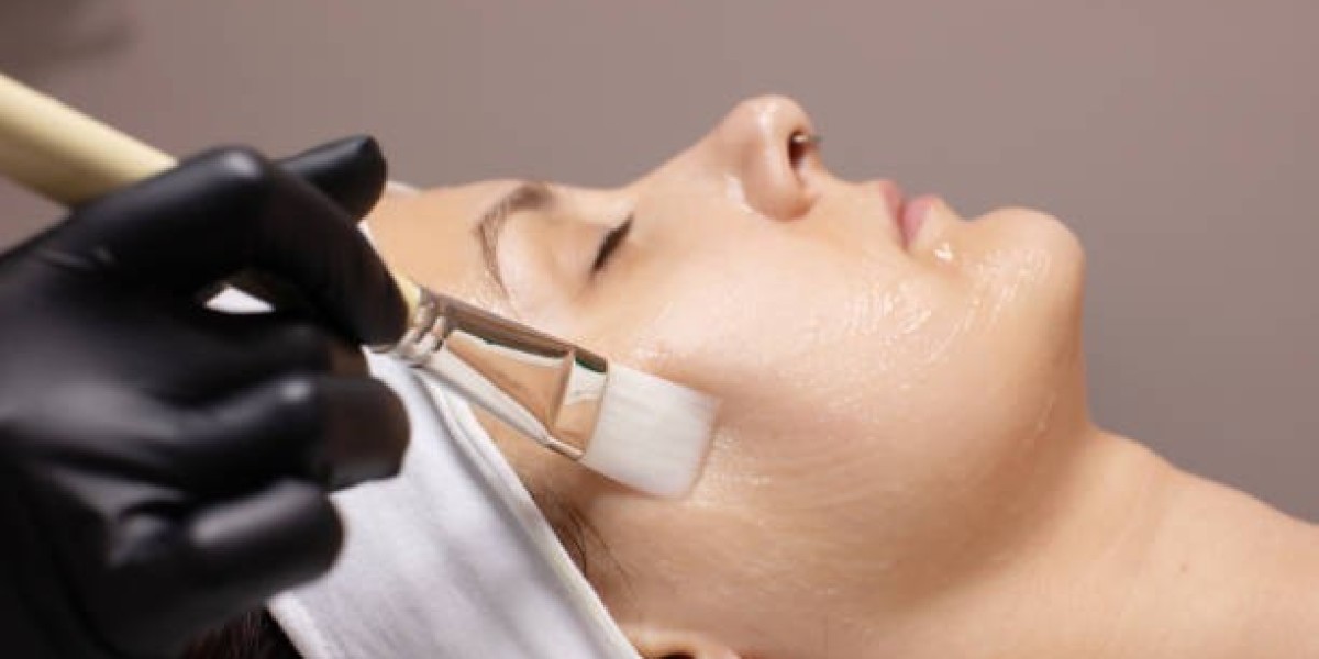 Chemical Peels vs. Lasers: Non-Invasive Skin Resurfacing Guide
