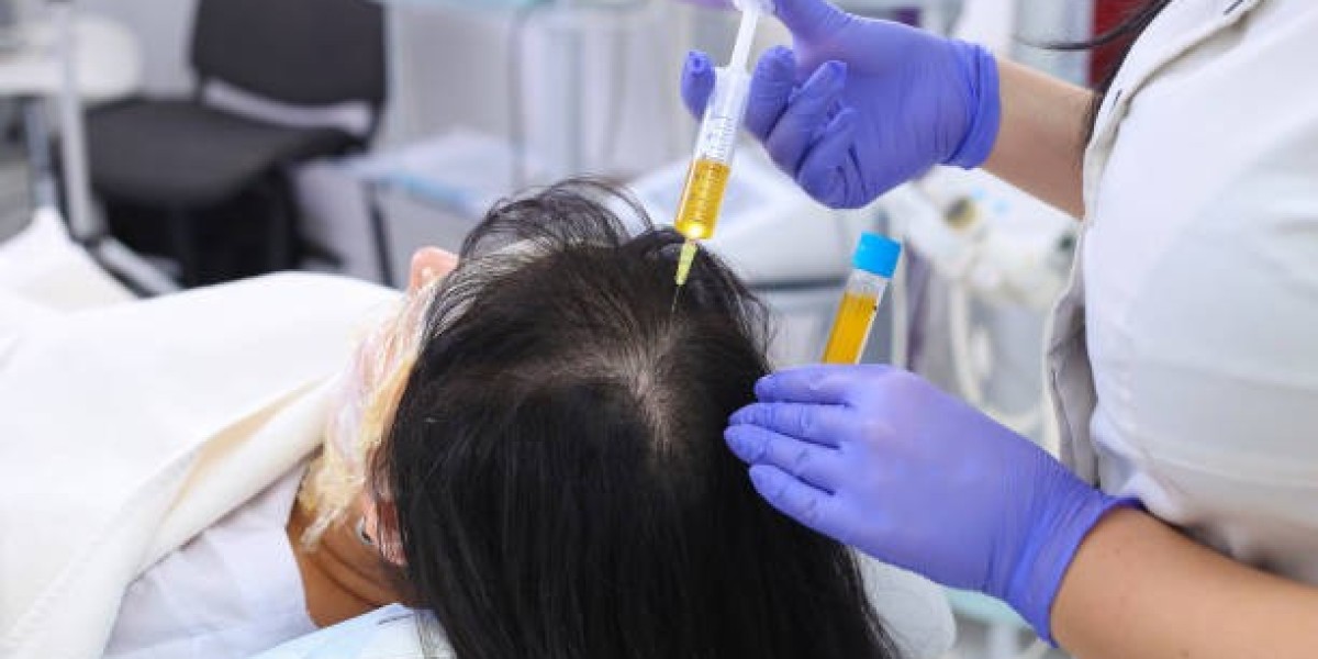 Revitalize Your Hair Naturally with PRP Hair Treatment in Islamabad