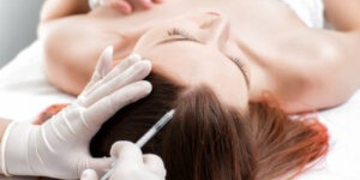 PRP Hair Treatment in Dubai: Combat Stress-Related Hair Loss for Professionals