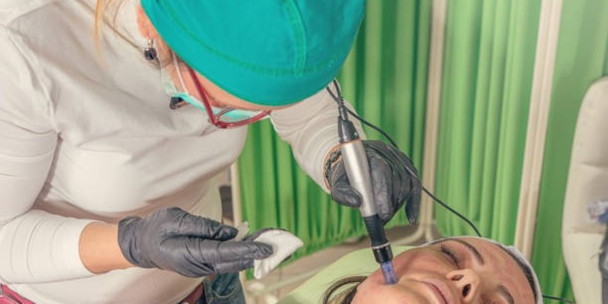 Pico Laser Treatment Myths Debunked