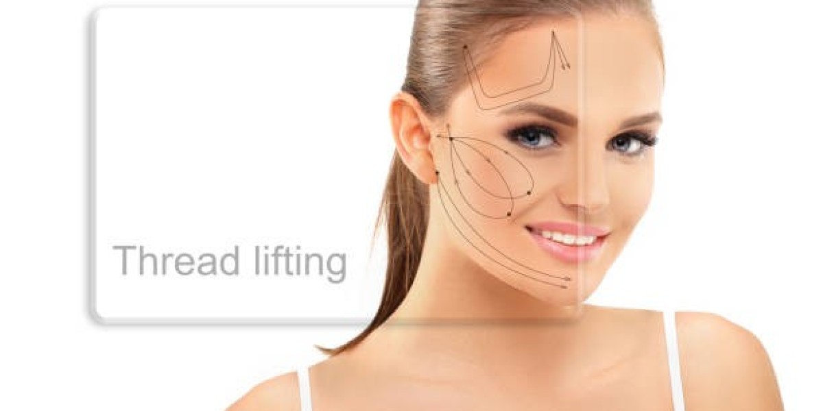 Thread Lift in Dubai Costs: Affordable Luxury Revealed