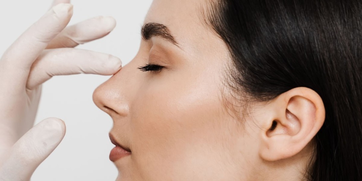 Managing Swelling and Bruising After Your Rhinoplasty