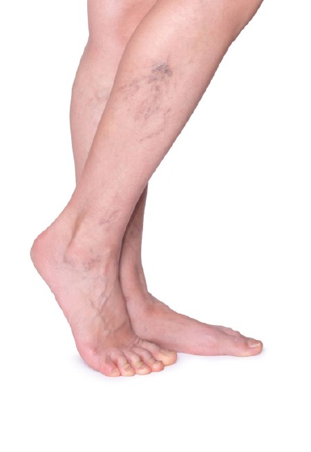 Lotuslaserskin