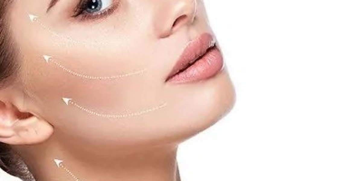 Can Silhouette Soft Lift Treat Facial Volume Loss?