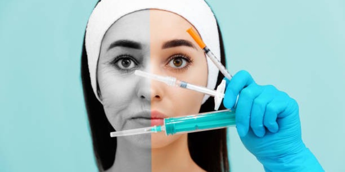 Redensity 2 Filler Injections Dubai: Do They Really Work?