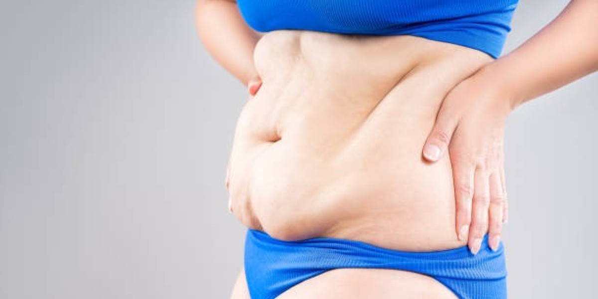Tummy Tuck Surgery in Older Adults: Safe Options