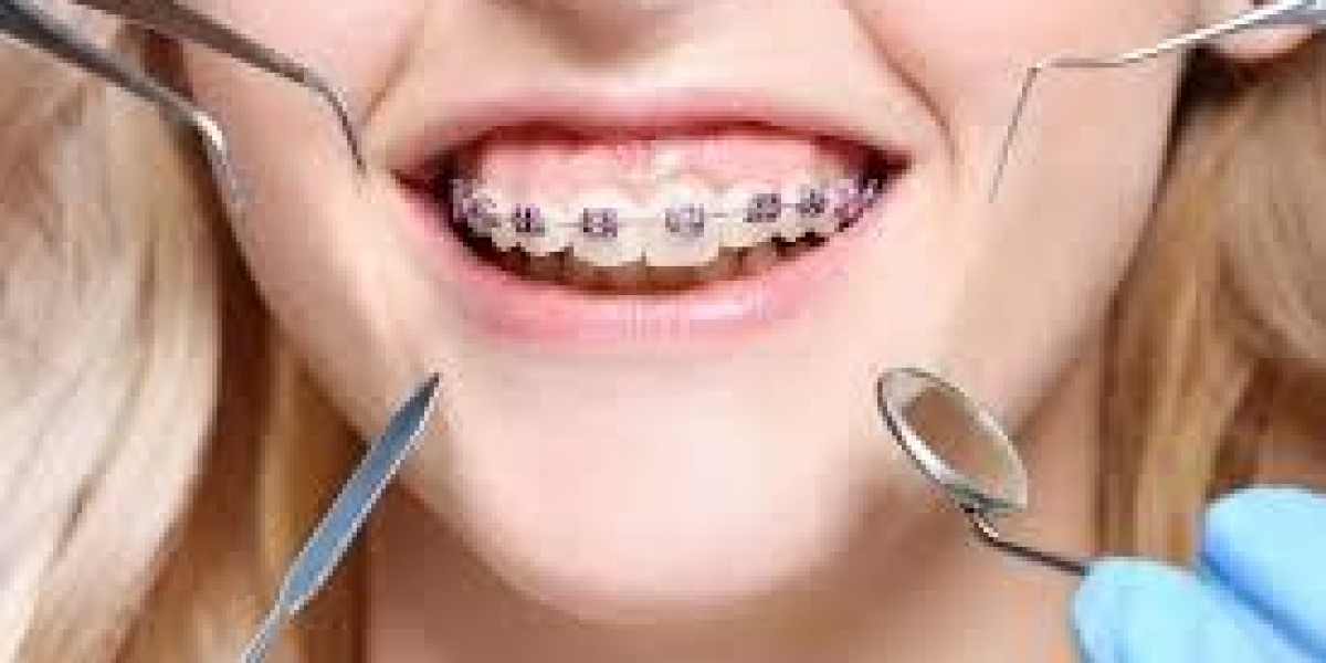 Orthodontics Market Size And Share Forecast 2034