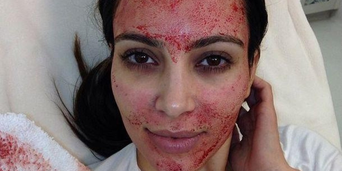 Vampire Facelift in Islamabad: How PRP Therapy Rejuvenates Your Skin