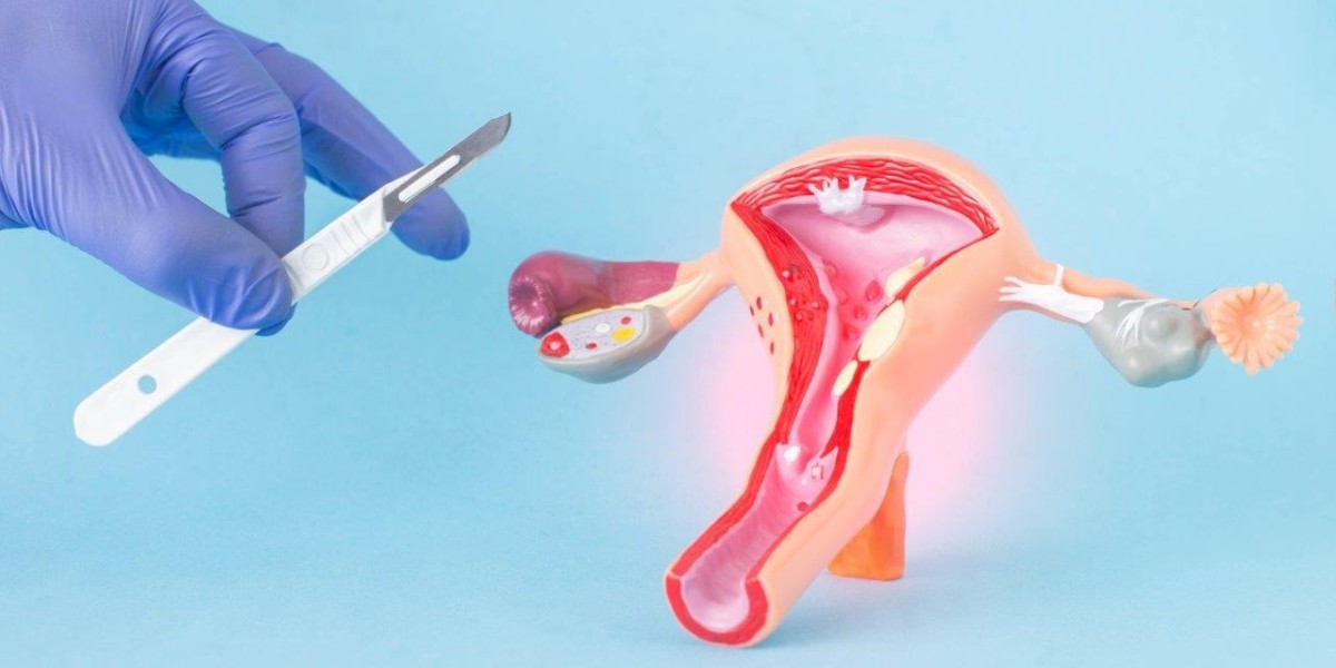 How Soon Can You Conceive After Myomectomy?