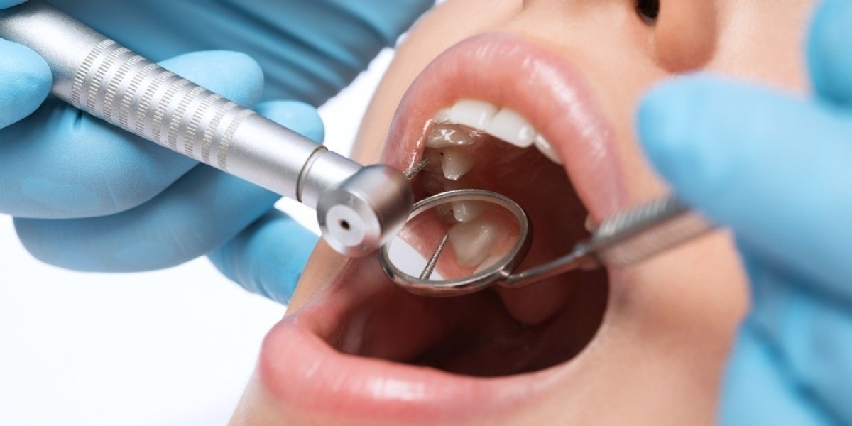 Is Tooth Extraction Cost in Dubai Worth It?