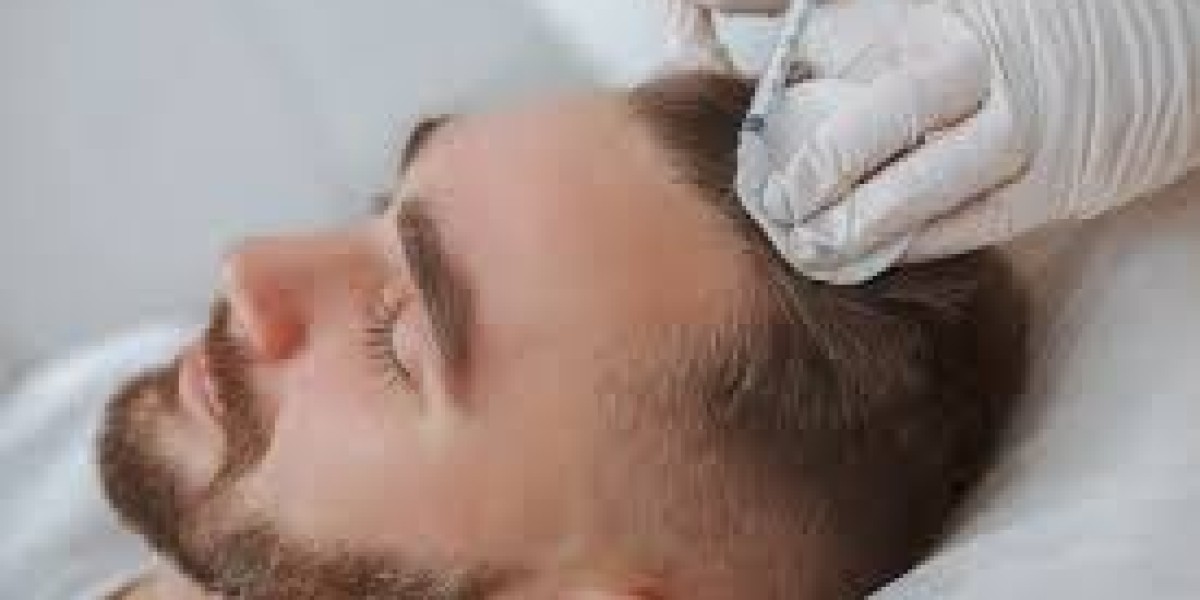 Expert PRP Services in Islamabad You Should Consider