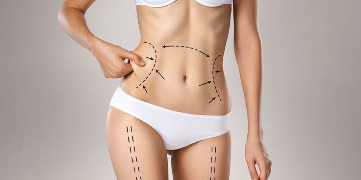 Understanding Recovery and Aftercare for Liposuction in Dubai