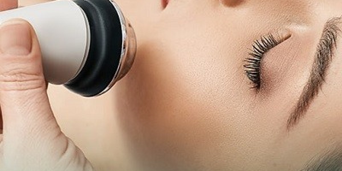 What Are the Benefits of Laser Facial Treatment?