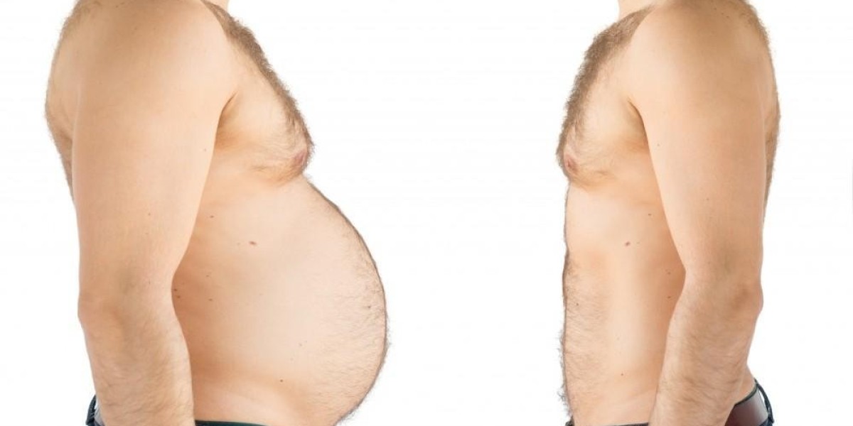 Best Bariatric Surgeons in Islamabad