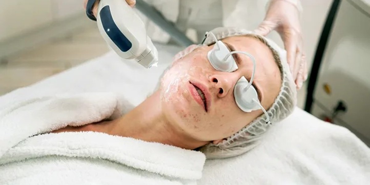 Does Laser Treatment Help Clear Skin Blemishes?