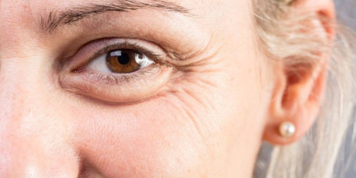 Eyelid Surgery in Islamabad: Transform Your Eyes with Expert Cosmetic Care