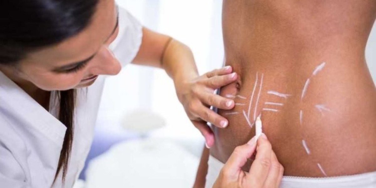 Understanding the Science Behind Body Contouring in Islamabad