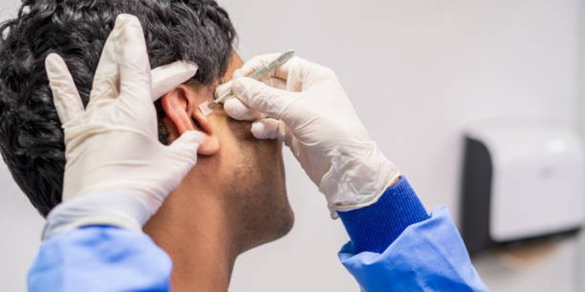Wondering About Preauricular Tag Removal in Dubai? Here's What You Need to Know