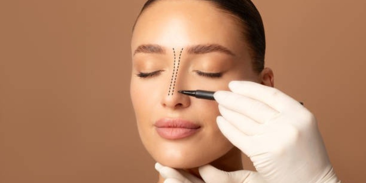 مراحل الشفاء النفسي بعد عملية تجميل الأنف في الرياض: توقعات واقعية