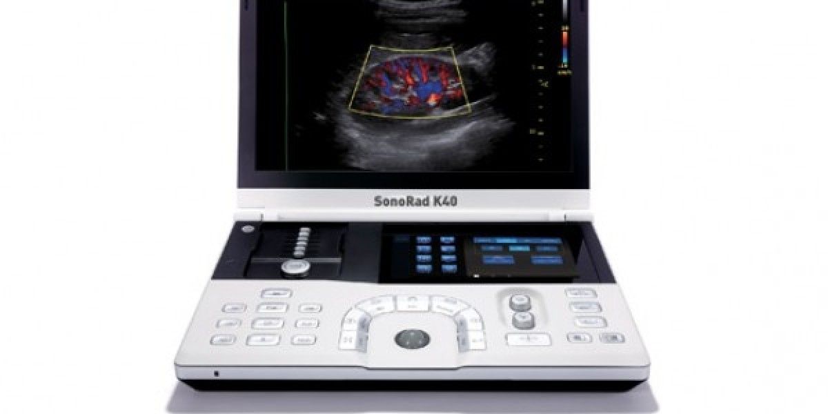 Understanding Colour Doppler Ultrasound Price: Factors, Benefits, and Value in Modern Diagnostics
