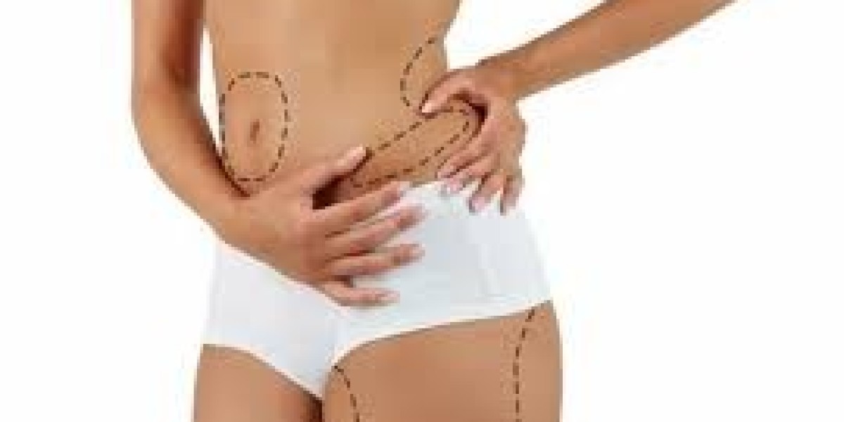 Minimally Invasive Liposuction Options in Islamabad