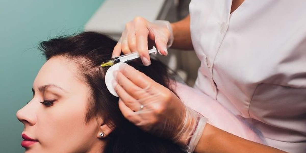 PRP Hair Treatment in Dubai: Step-by-Step Process Explained