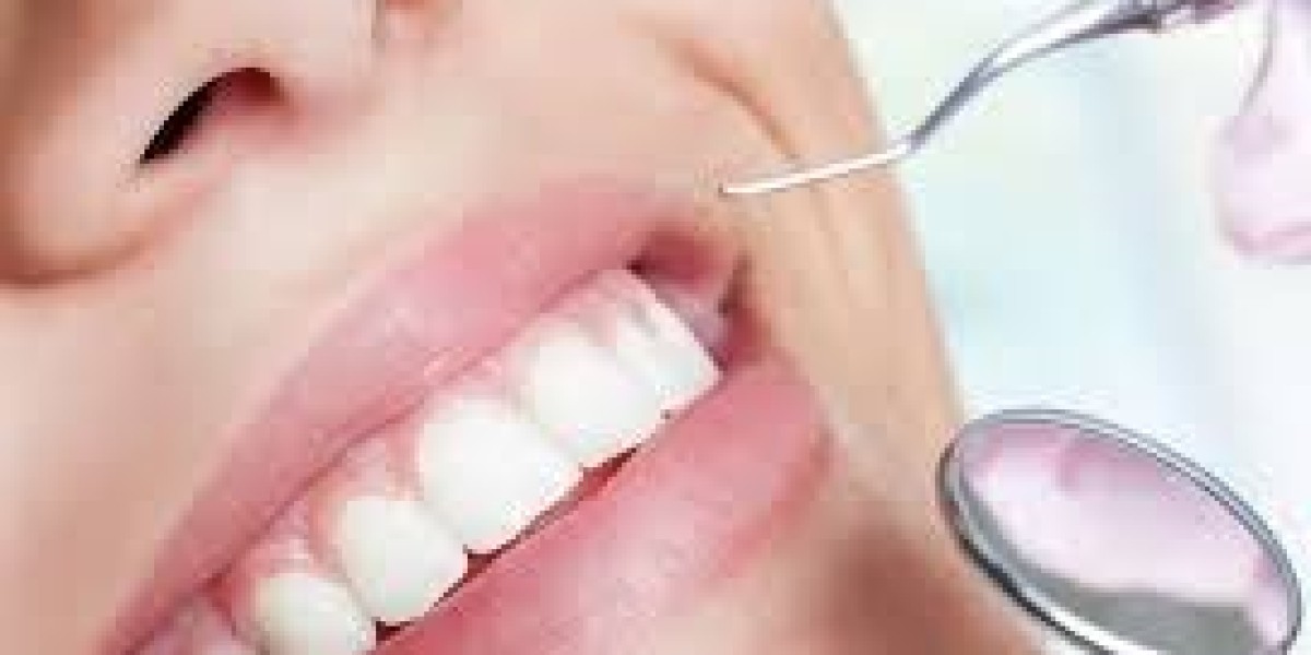 How Much Does Teeth Scaling and Polishing Usually Cost?
