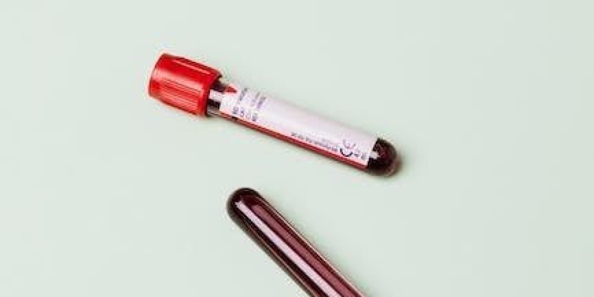 The Latest Technology Used for STD Test in Dubai