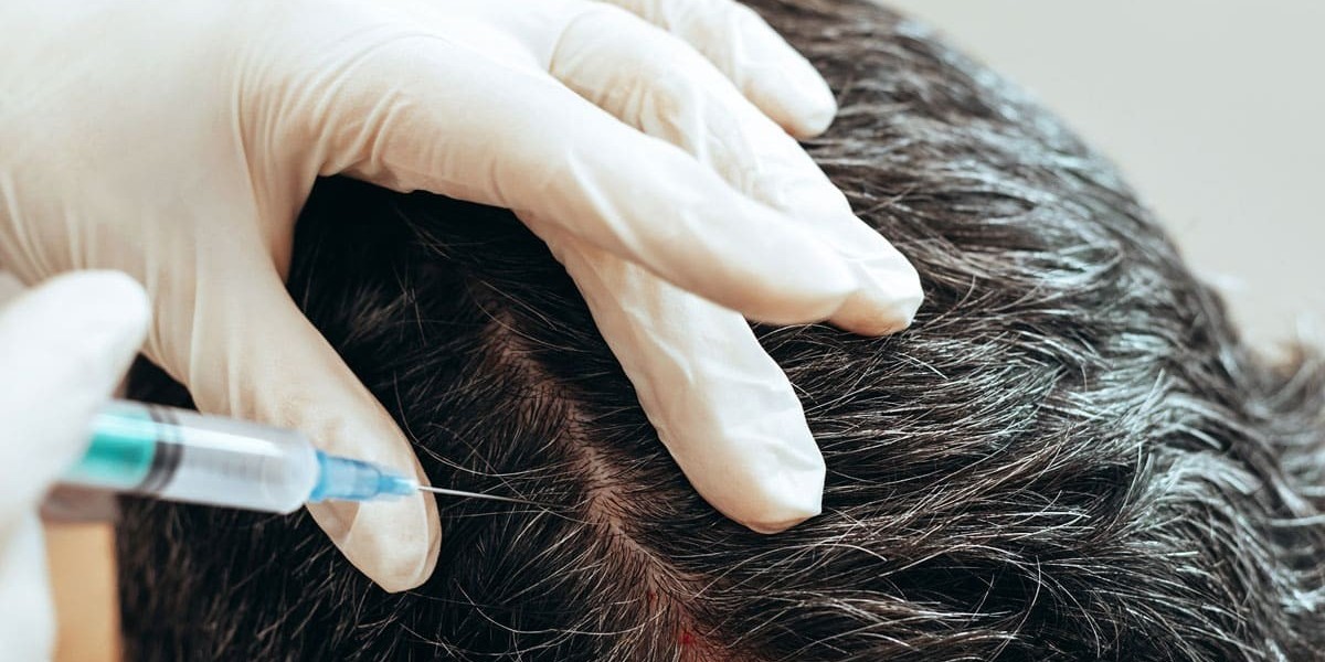 Best PRP Hair Treatment for Afro-Textured Hair