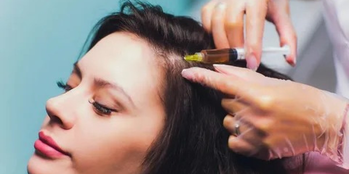 PRP hair treatment in Dubai: A Smart Choice for Healthy Growth