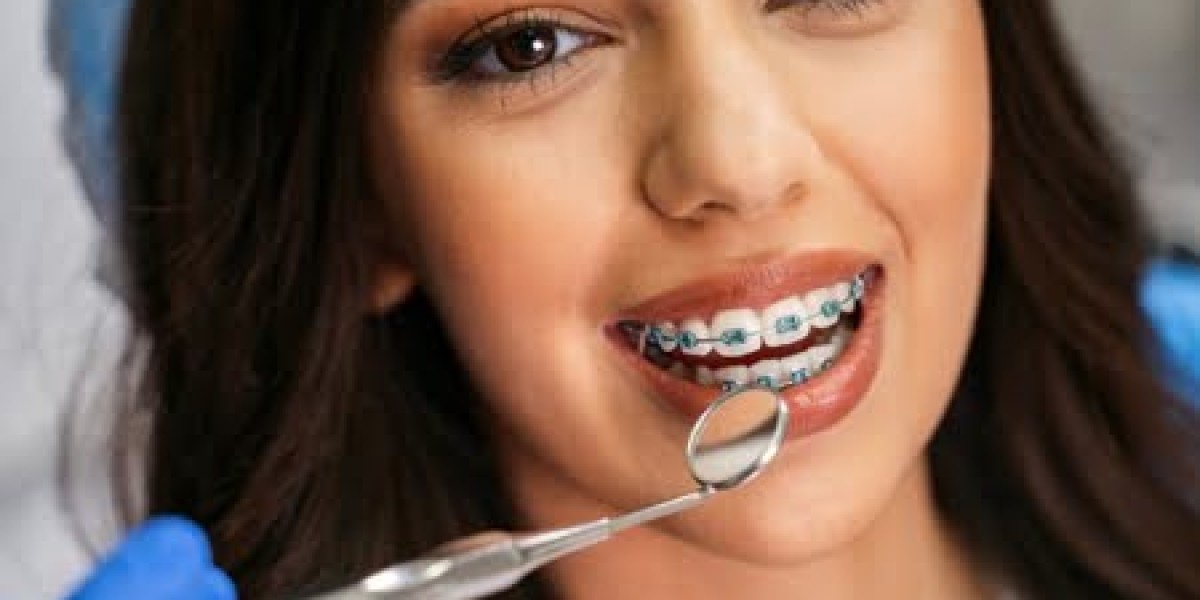 Dental Braces in Pune: Complete Treatment Guide & Cost | Diagnopein Dental Care