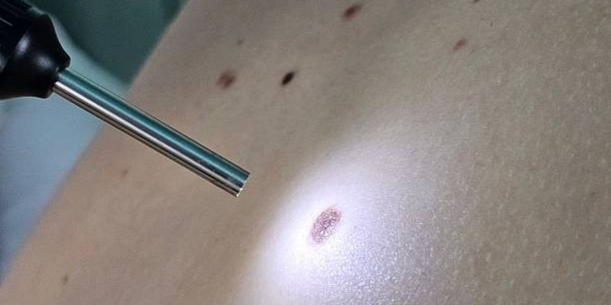 Skin Lesion Removal in Dubai: Innovation for Everyday Heroes