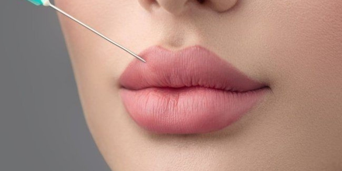 Fillers Treatments in Dubai for Expert Care
