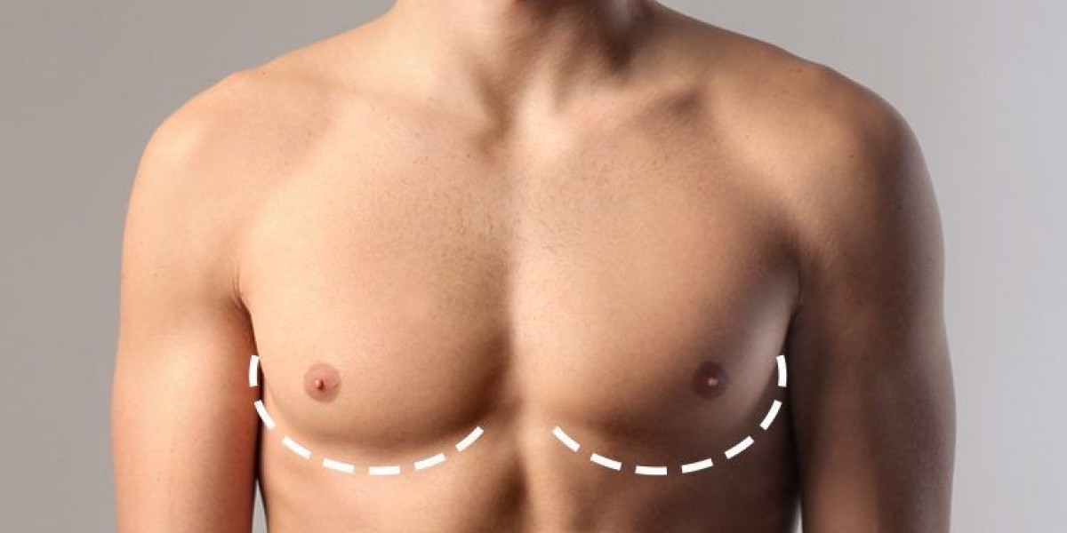 Gynaecomastia Surgery in Dubai: Advanced Techniques for Natural-Looking Results