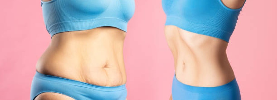 Liposuction Saudia