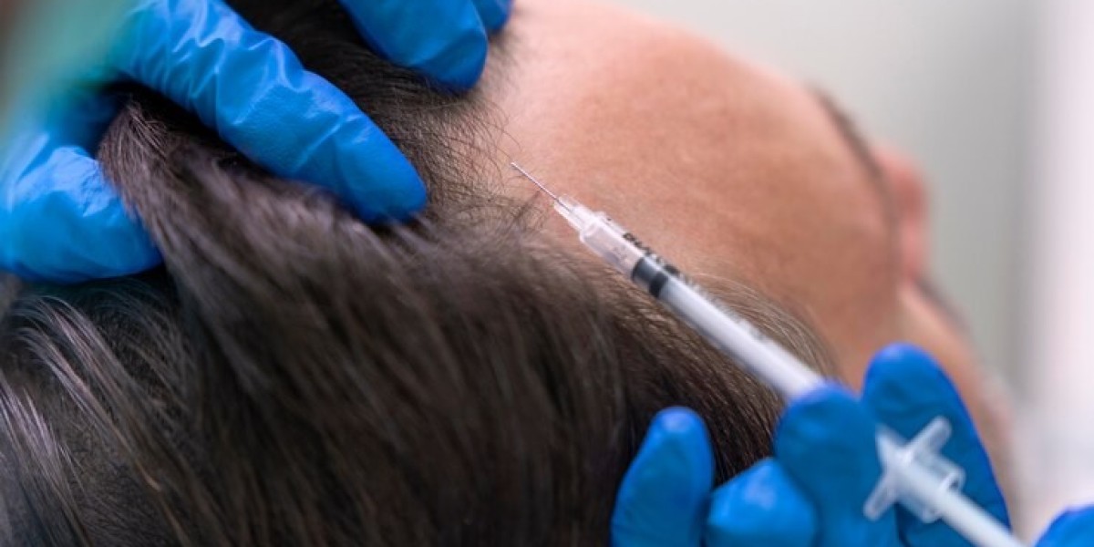 Mesotherapy Market Set to Surge as Personalized, Non-Invasive Treatments Gain Popularity