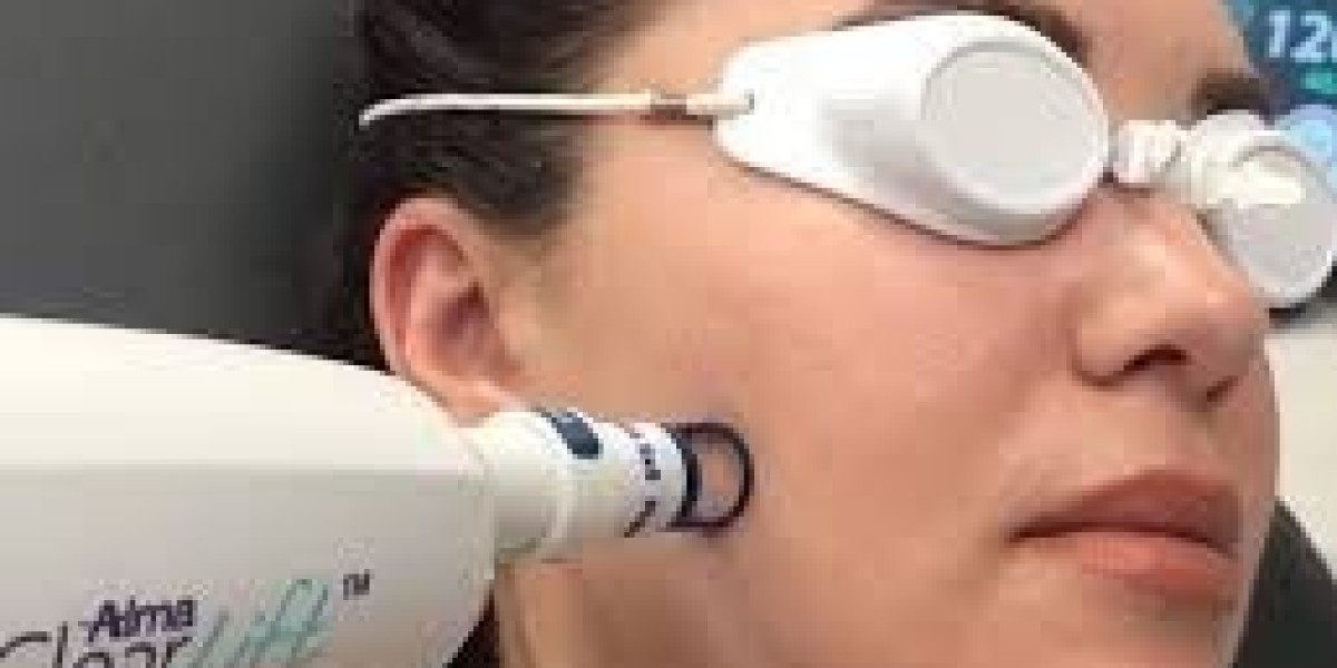 Is ClearLift Laser Safe for Sensitive and Darker Skin Tones?