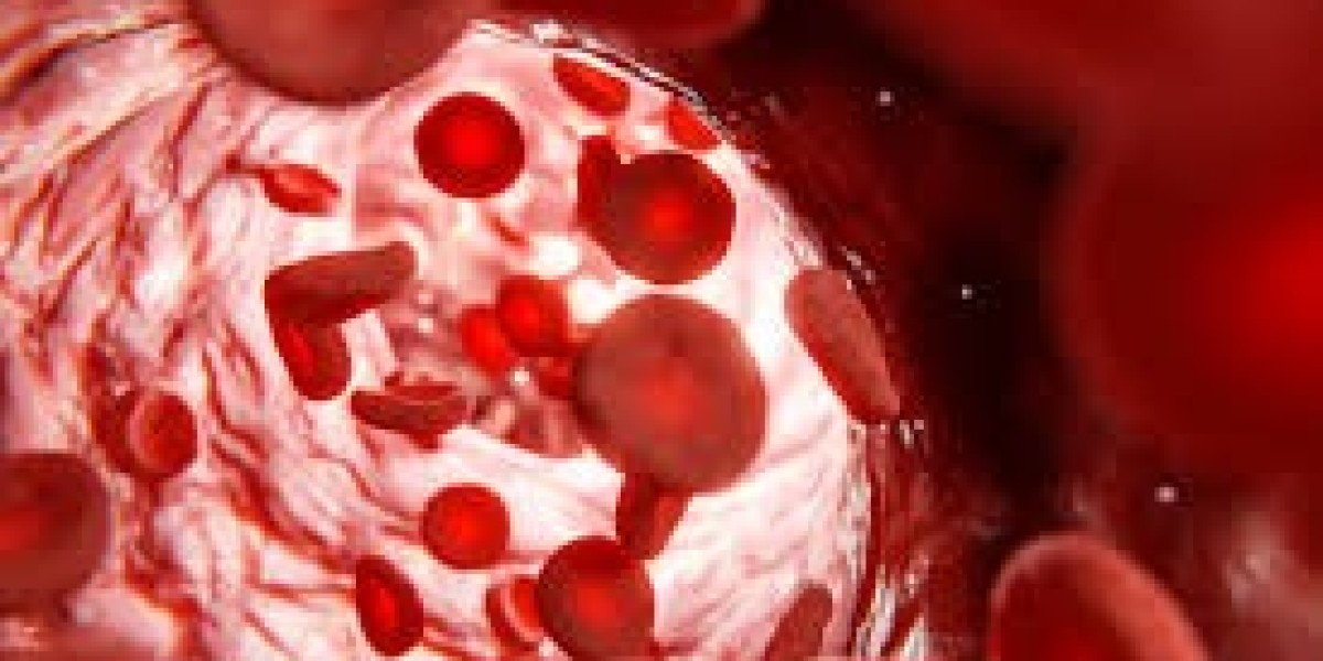 Effective Diet Plans to Manage High Cholesterolemia in Dubai