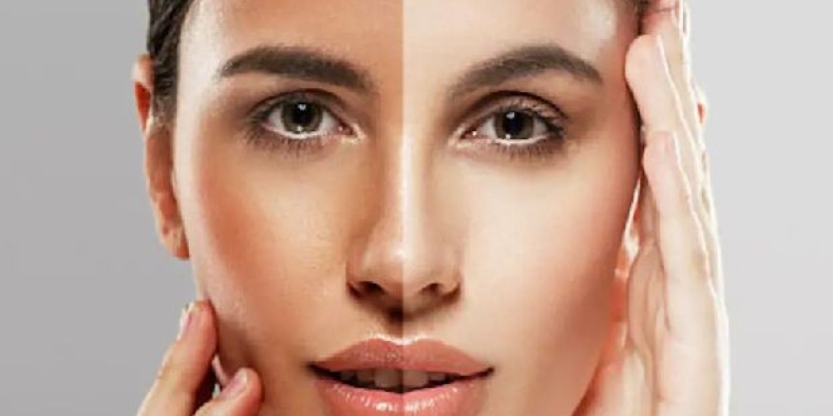 Glutathione Injection in Dubai: A Complete Guide to Brighter, Healthier Skin