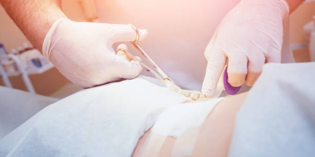 Hymenoplasty Surgery in Islamabad: Restoring Confidence with Privacy