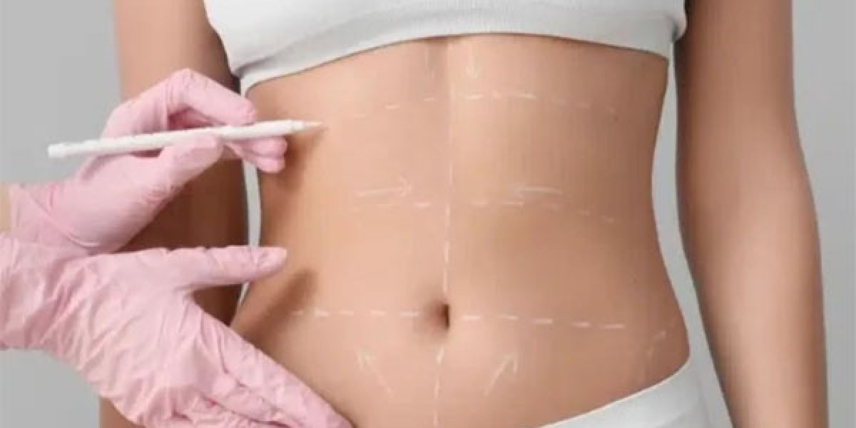 Recovery After HD Liposuction Dubai: Timeline, Care, and Results