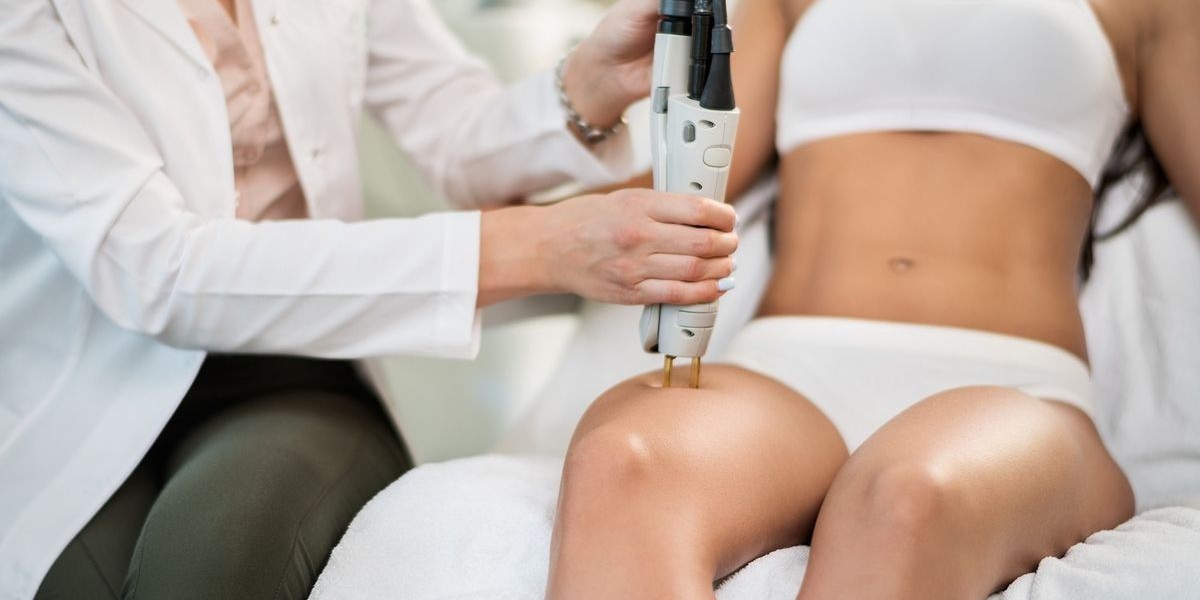 Laser Hair Removal in Dubai: Achieving Maximum Results Safely and Effectively