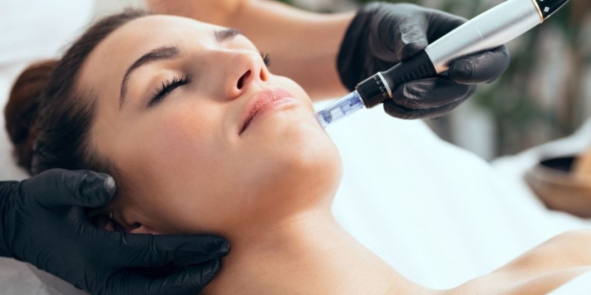 Is Microneedling Safe for All Skin Types?