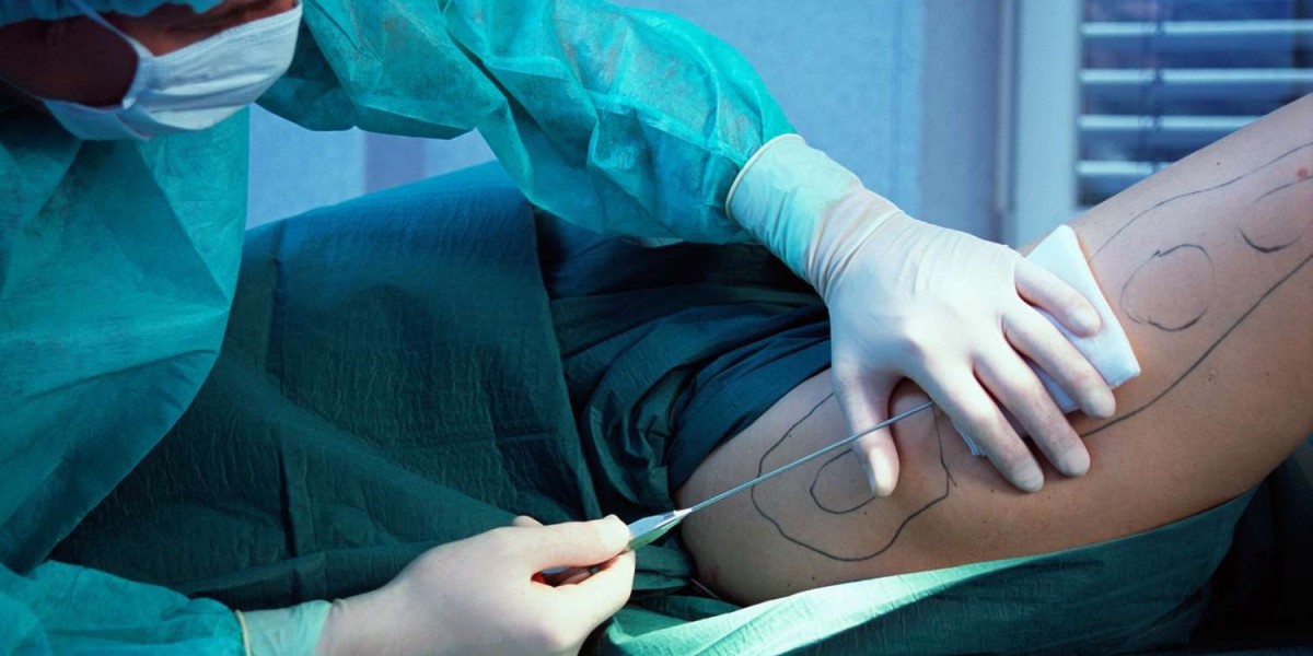 Affordable Liposuction Procedures in Dubai