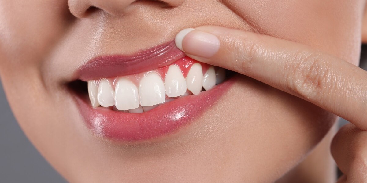What Is the Purpose of Pink Gums With Laser Therapy?