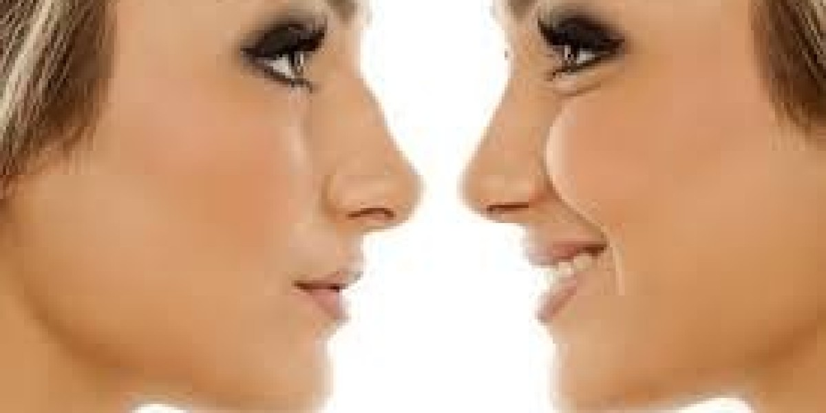 Affordable Rhinoplasty Procedures in Dubai