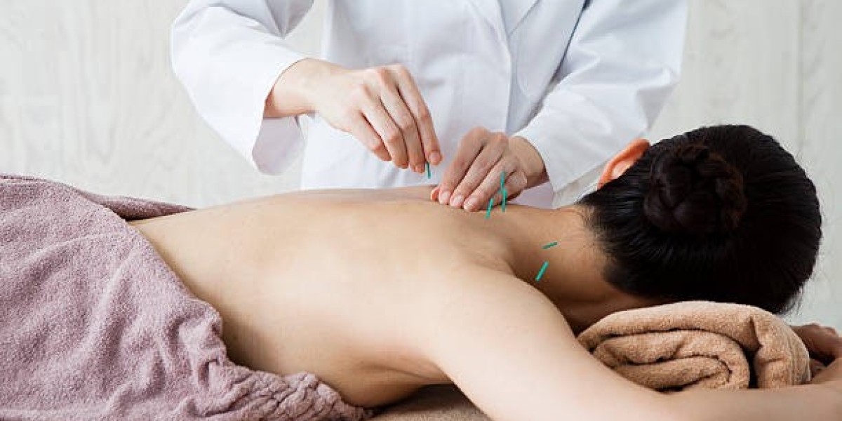 Acupuncture Treatment in Dubai Strengthens Immunity Now