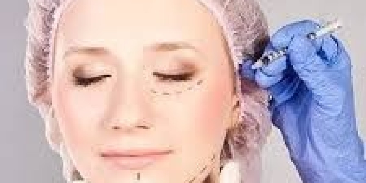 Is Sculptra better than fillers?