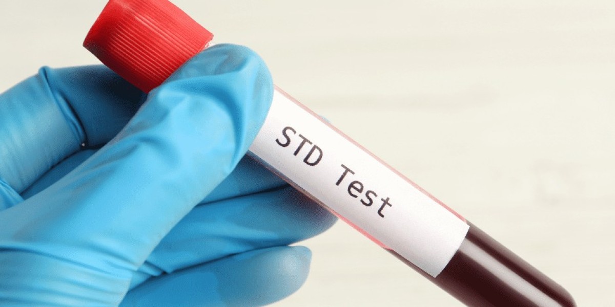 STD Test Timing: When Symptoms Appear