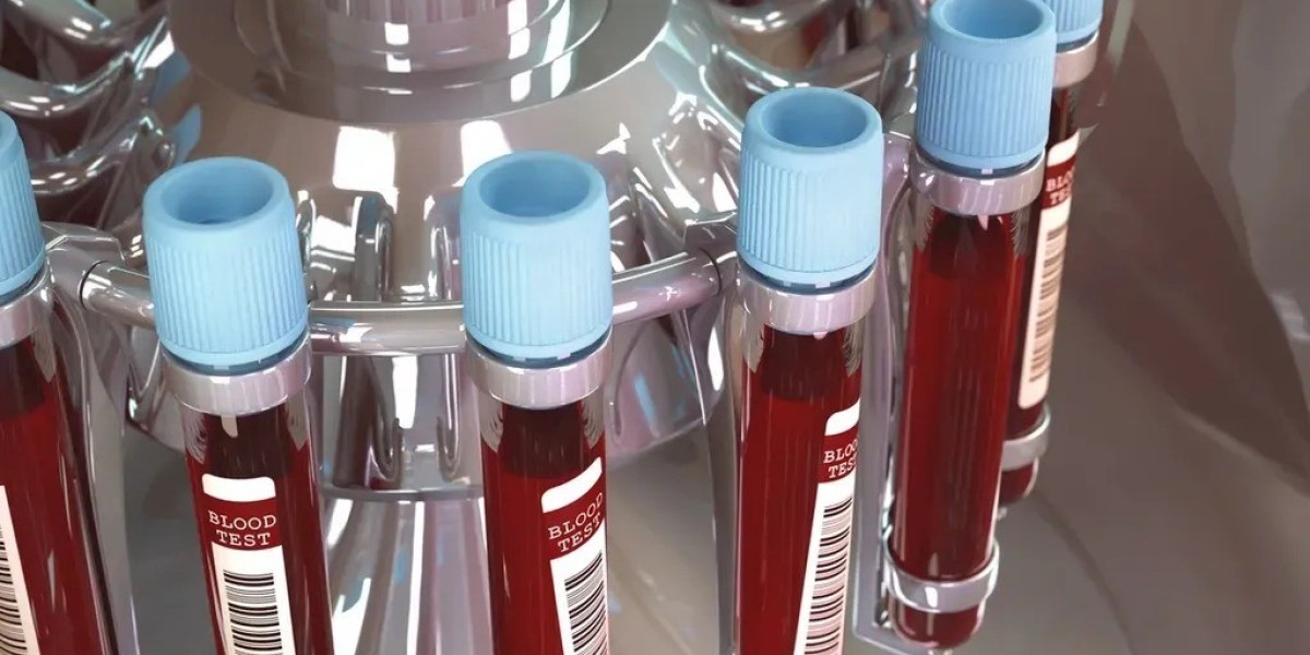 private blood tests Nottingham